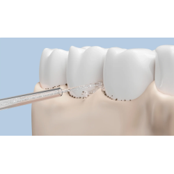 Xiaomi Water Flosser Burnos irigatoriaus antgaliai